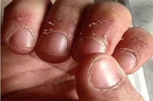 兰陵吃指甲盖的瓜视频